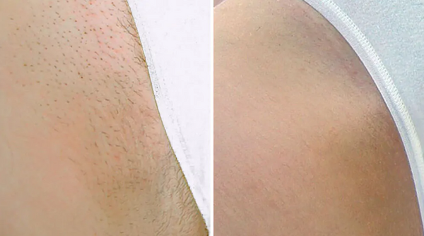 Review photo by Hannah