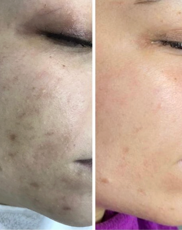 Review photo by Hannah