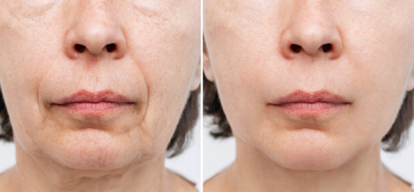 Review photo by Lily