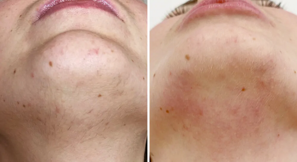 Review photo by Grace