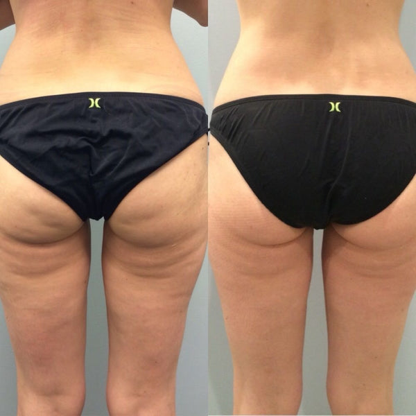 Review photo by Kayla