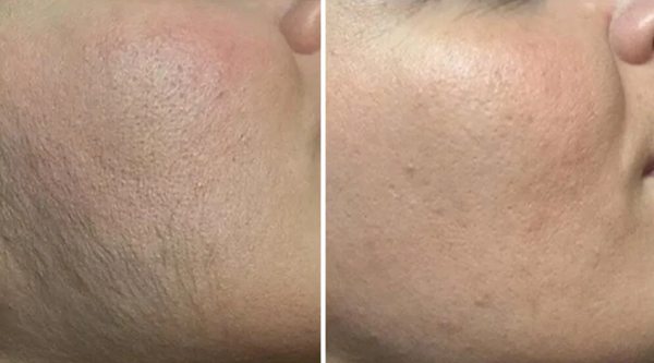 Review photo by Scarlett