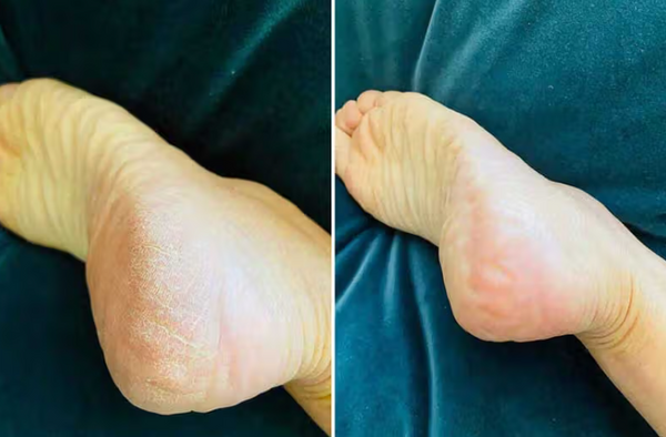 Review photo by Amelia